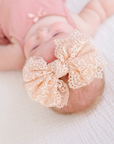 Lace FAB®